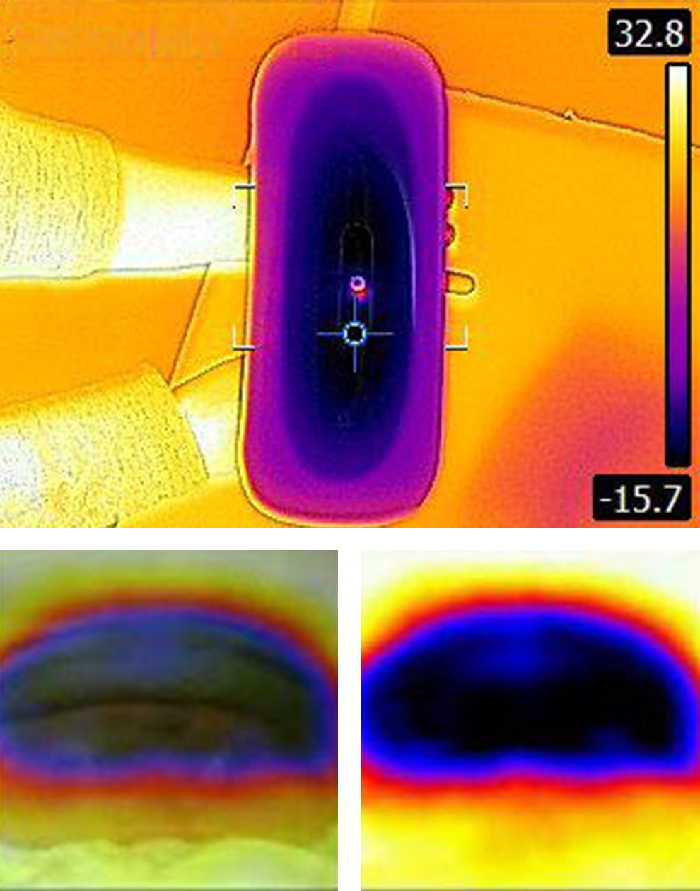 Illustration du travail de notre machine Skinxpert Sculptice sur les cellules graisseuses